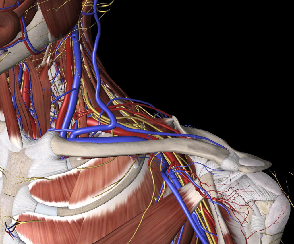 Thoracic-Outlet-Syndrom – ein verständlicher Überblick